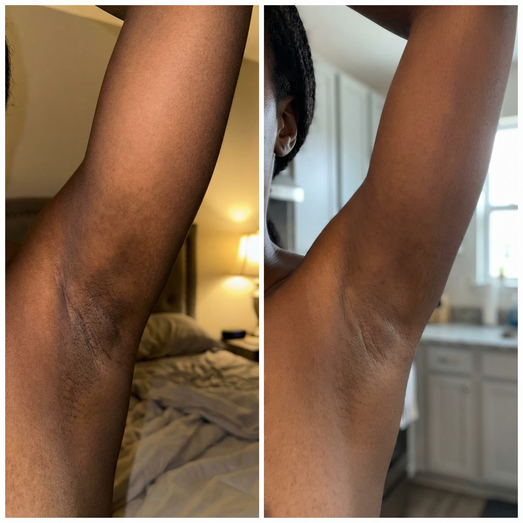 Sion Korean Toner Pads - Skincare for Dark Spots, Wrinkles & Dull Skin