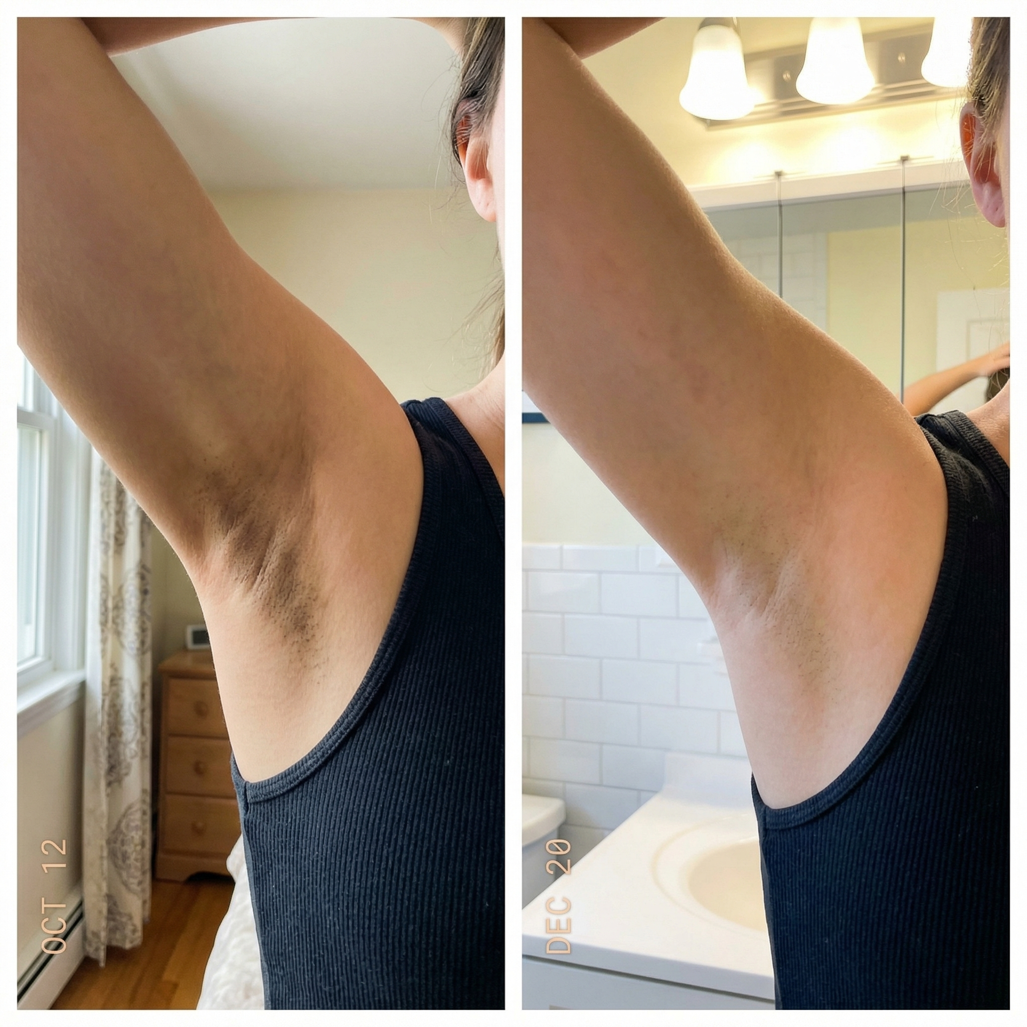 Sion Korean Toner Pads - Skincare for Dark Spots, Wrinkles & Dull Skin