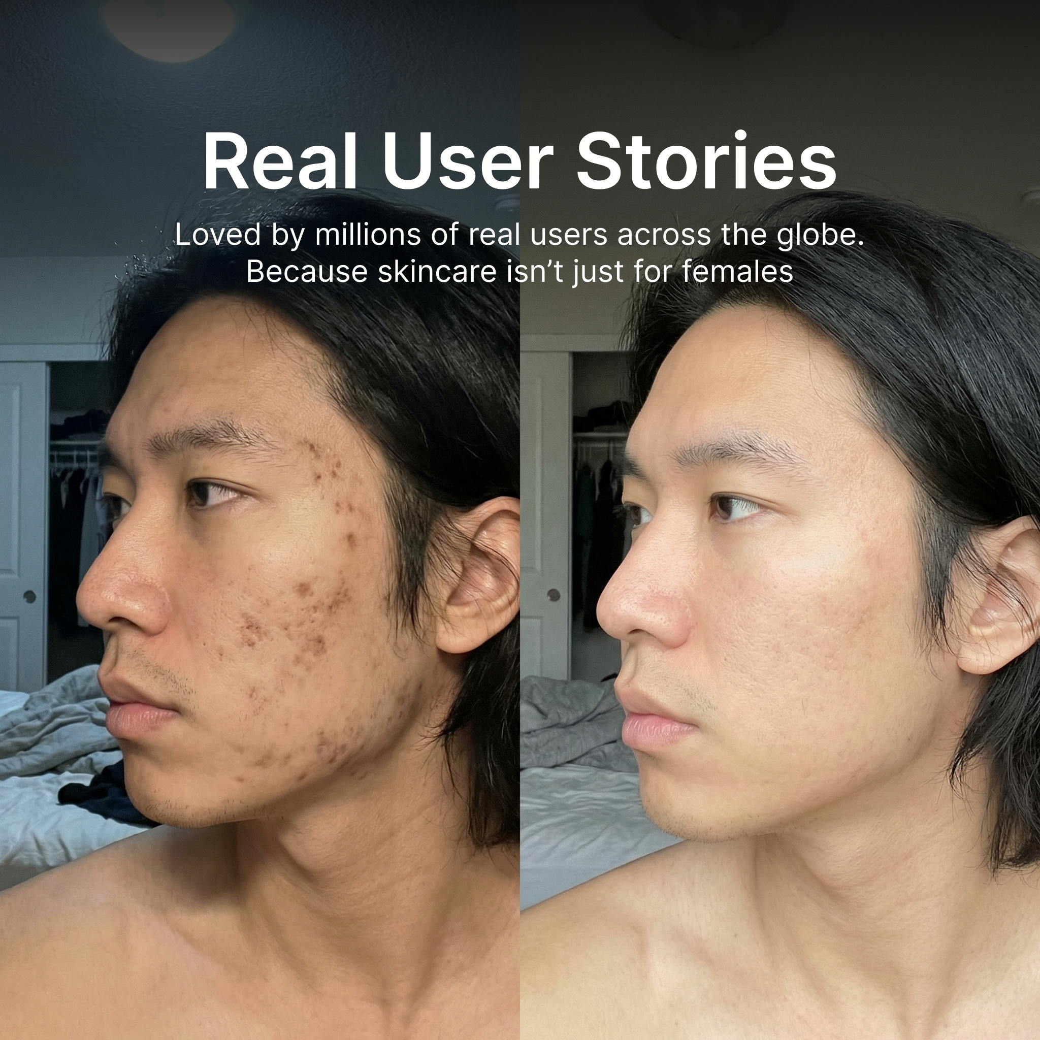 Sion Korean Toner Pads - Skincare for Dark Spots, Wrinkles & Dull Skin for Males